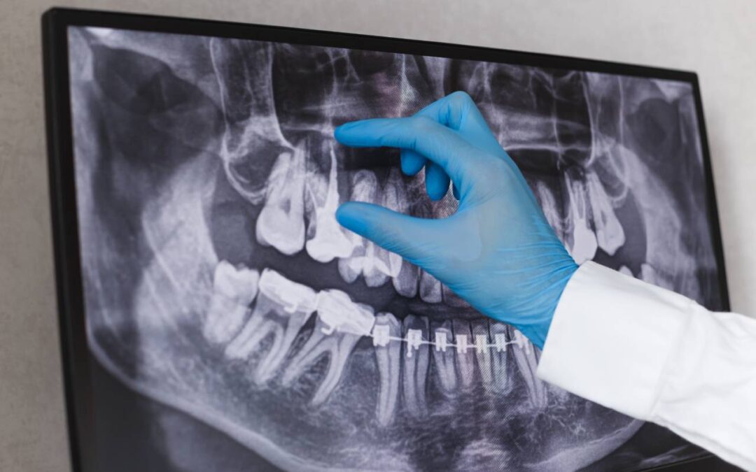 dentist looking at root canal xray