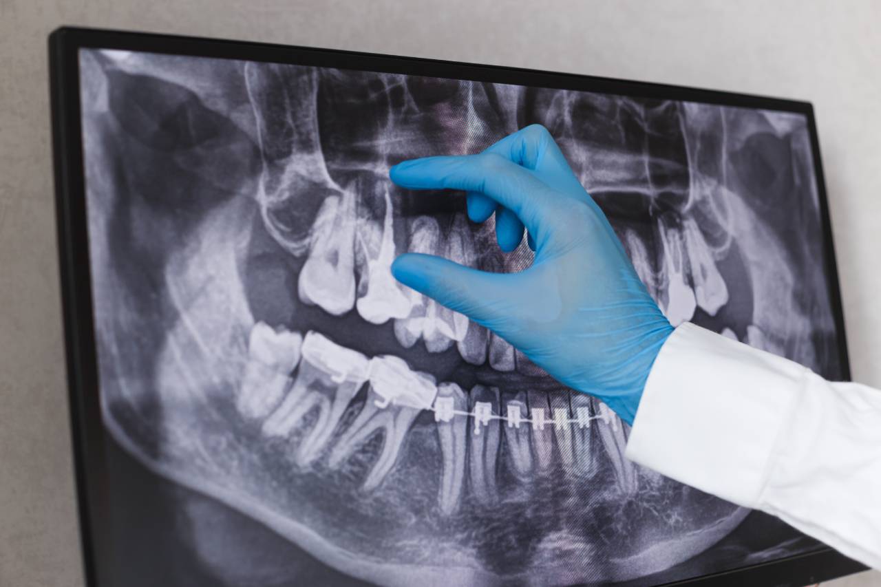 dentist looking at root canal xray