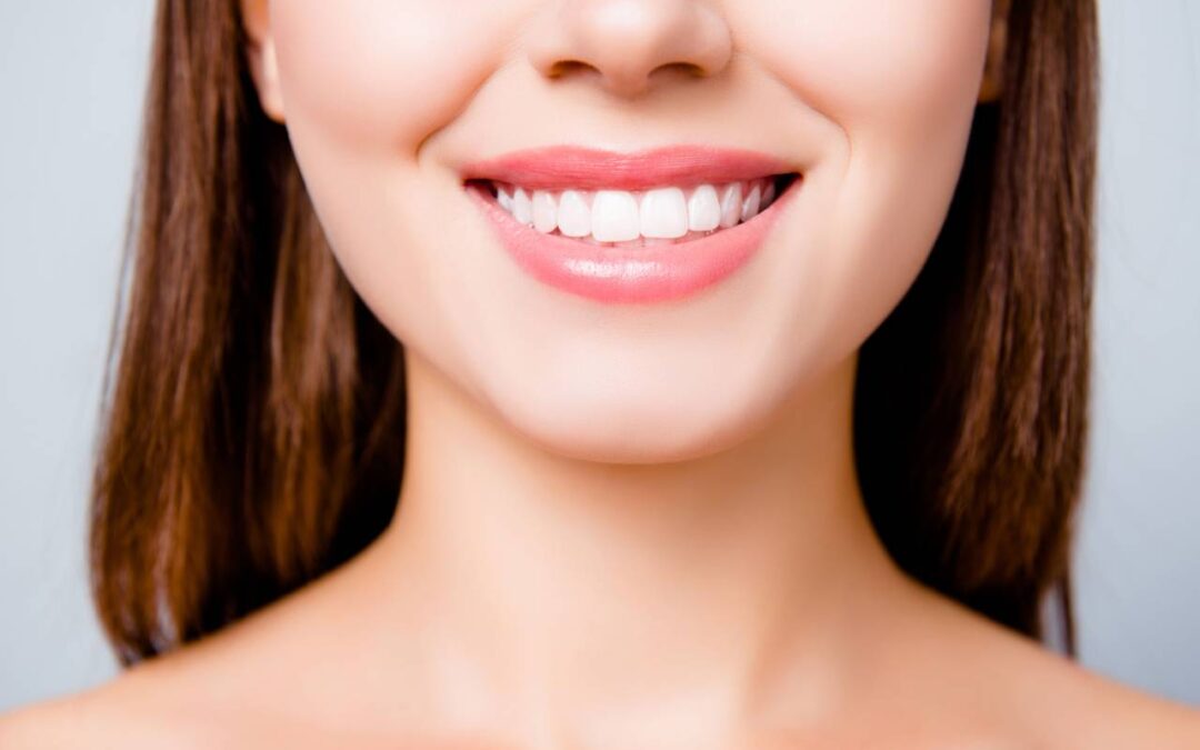brunette woman with white teeth smilinh